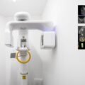 -3-boyutlu-gorunutuleme-dental-tomografi-nedir-